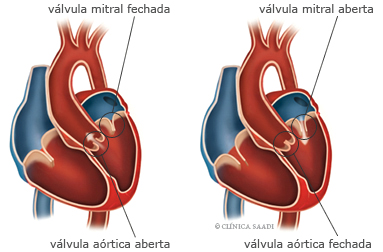 Endocardite. Válvula Mitral fechada e aberta e Válvla aórtica aberta e fechada