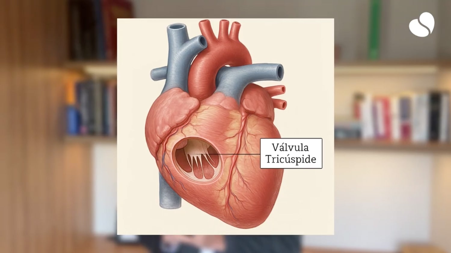 Imagem mostrando a Válvula Tricúspide
